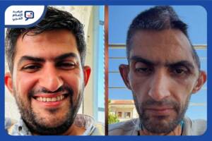 نشر الصحفي الفلسطيني مجاهد بني مفلح صورةً حديثة له بعد رحلة علاج طويلة أعقبت الإفراج عنه من سجون الاحتلال الإسرائيلي، مرفقًا إياها بشهادة شخصية تحدّث فيها عن آثار السجن والمرض، وما تركته التجربة من تحوّلات جسدية ونفسية عميقة.