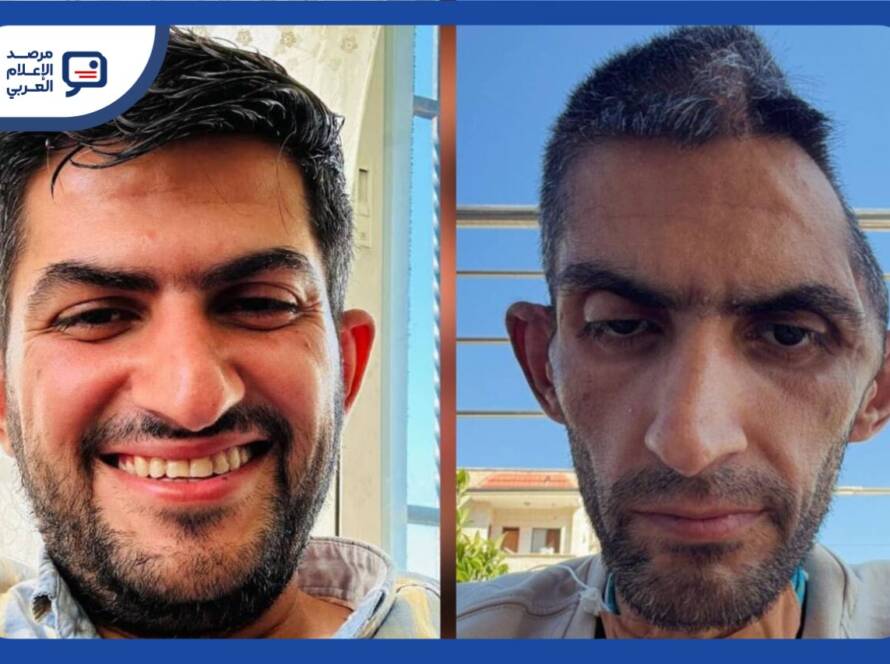 نشر الصحفي الفلسطيني مجاهد بني مفلح صورةً حديثة له بعد رحلة علاج طويلة أعقبت الإفراج عنه من سجون الاحتلال الإسرائيلي، مرفقًا إياها بشهادة شخصية تحدّث فيها عن آثار السجن والمرض، وما تركته التجربة من تحوّلات جسدية ونفسية عميقة.
